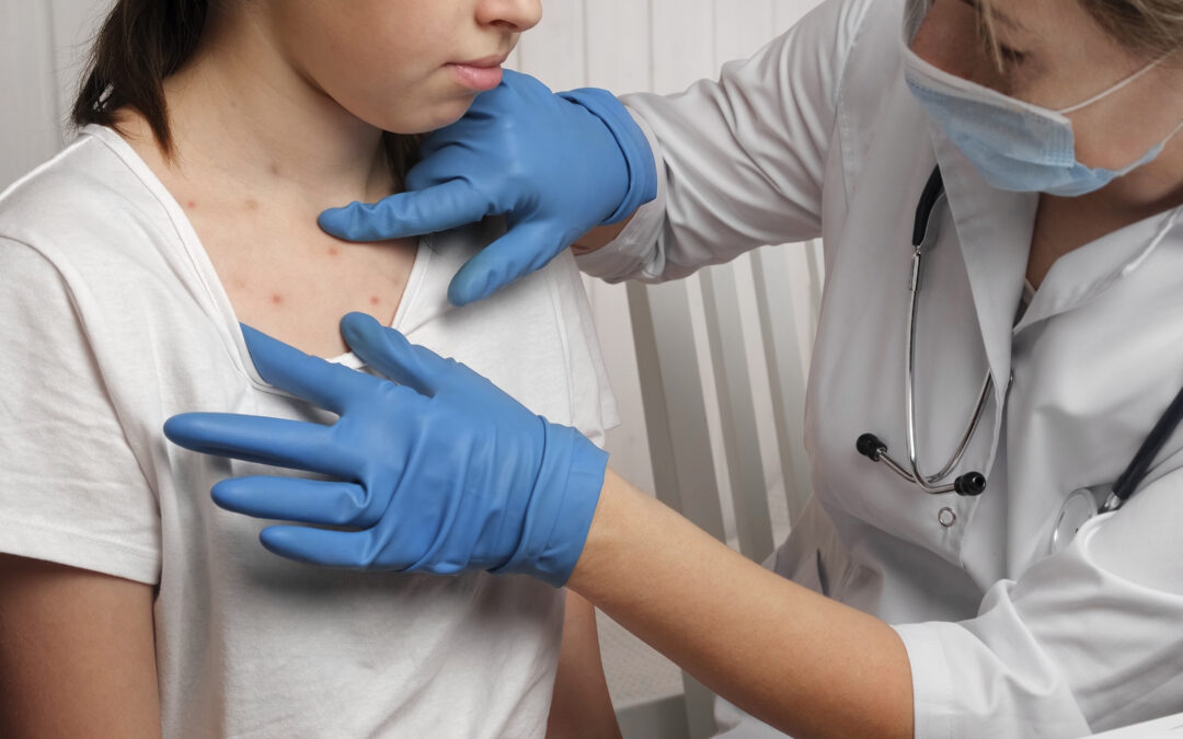 Dr. looking performing an exam on a child that has chicken pox